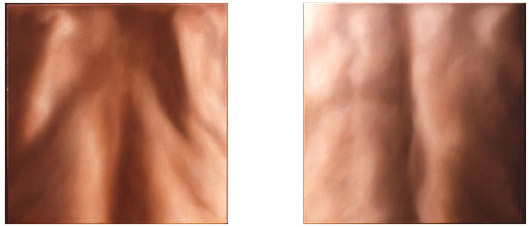 Skin Diptych (Tim and Mark)